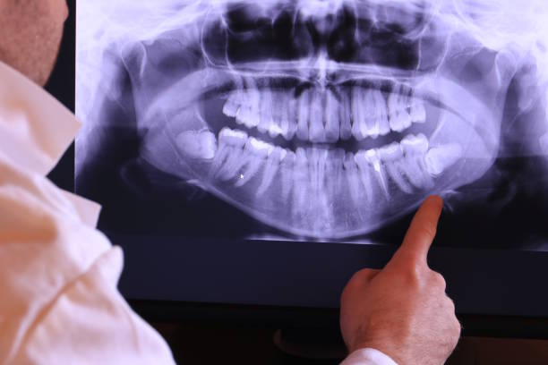 Best Emergency Treatment for Toothache in Biltmore, TN