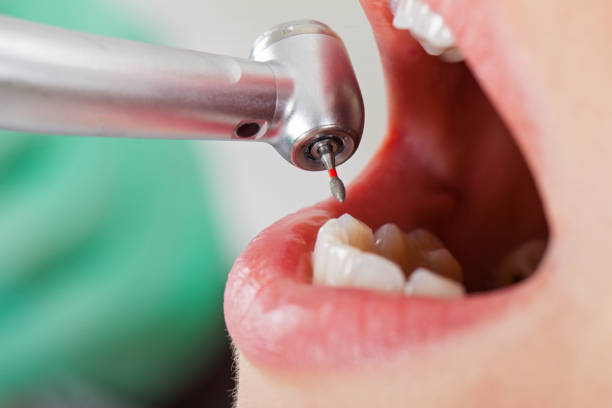 Best Emergency Orthodontic Repairs in Biltmore, TN